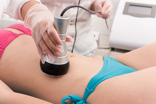 Laser Fat Reduction